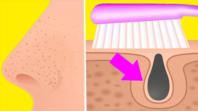 Cette astuce simple pour éliminer les points noirs va changer votre routine beauté…