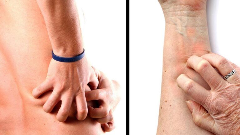 Cette astuce simple révèle 5 signes inquiétants que tes reins te donnent …