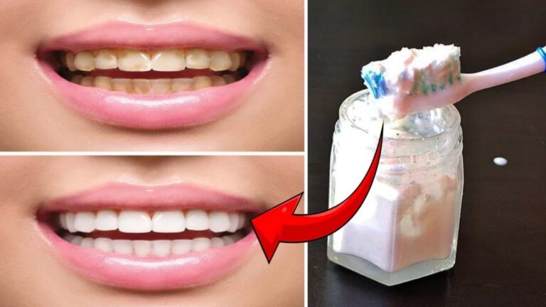 Cette ancienne méthode naturelle peut raviver l&rsquo;éclat de vos dents…