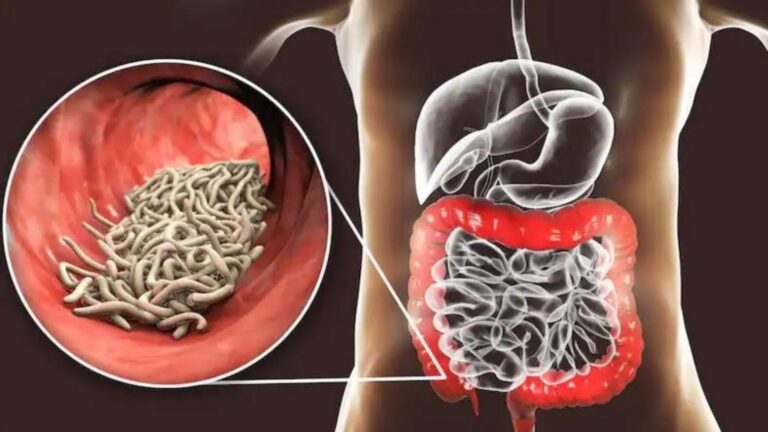 Cette astuce oubliée élimine les parasites de votre corps… santé et bien-être garantis !