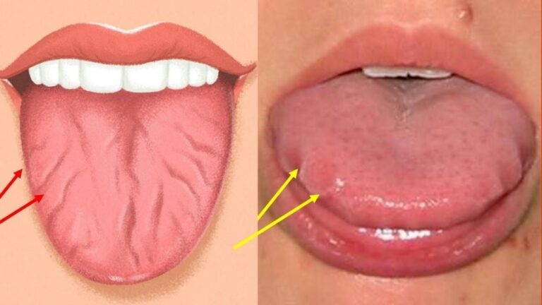 Cette astuce méconnue pour votre langue peut transformer votre santé…