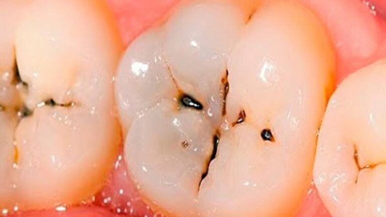 Cette méthode insoupçonnée rend vos dents éclatantes… Découvrez comment en 5 étapes