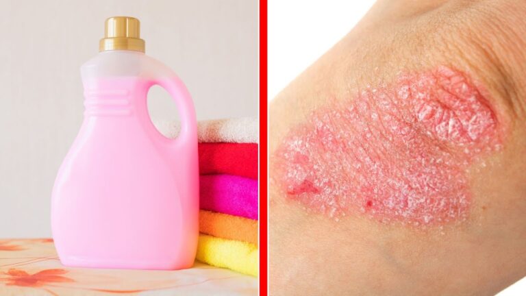 5 raisons pour lesquelles le fabric softener nuit à ta peau ! Découvre le vrai danger.