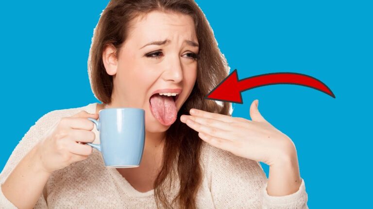 Ce qui arrive vraiment à ton corps après une brûlure de langue : 5 effets surprenants à découvrir !