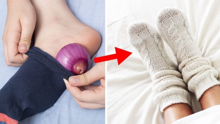 Découvre 5 bénéfices incroyables de mettre une oignon dans ta chaussette la nuit !