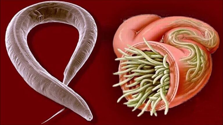 10 remèdes essentiels pour éliminer les parasites naturellement et efficacement