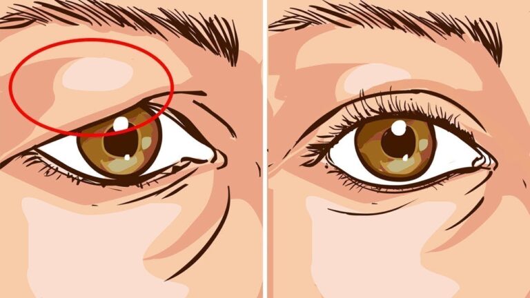 5 astuces naturelles pour traiter les paupières tombantes efficacement