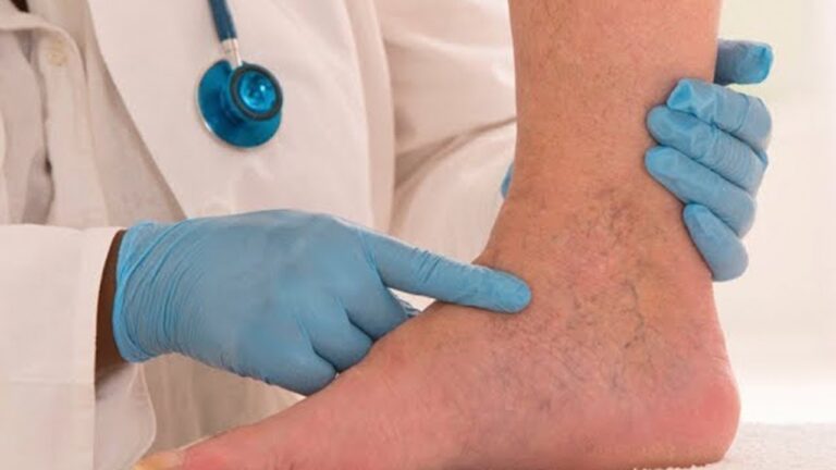 5 astuces simples pour améliorer ta circulation sanguine dès aujourd&rsquo;hui