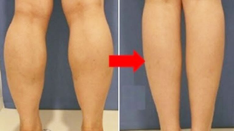 5 étapes pour avoir des mollets sculptés en quelques semaines !