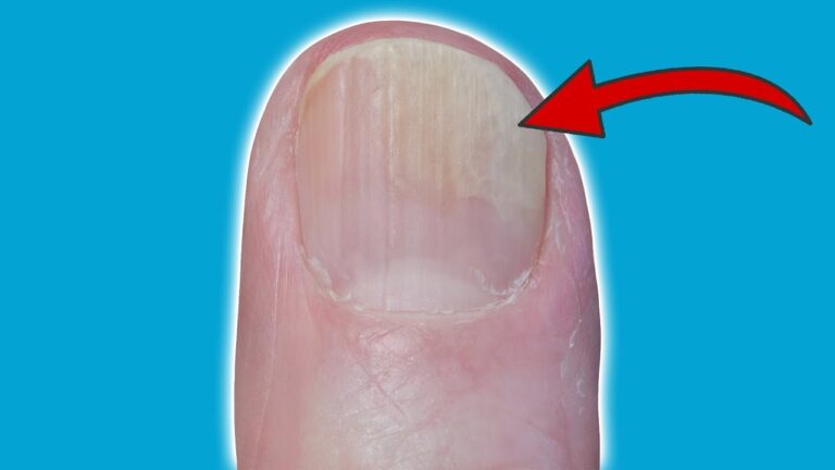 Résolvez 5 problèmes de ongles avec ces remèdes maison faciles et efficaces !